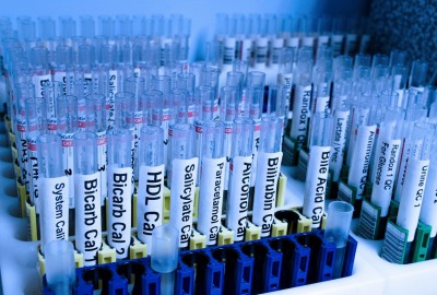 Test Etiketten für pharma, Spital